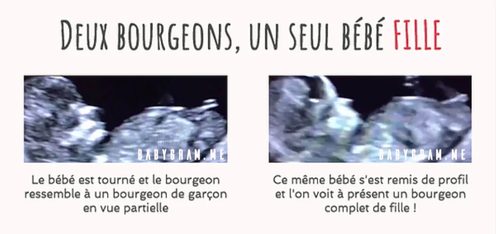 La Methode Du Bourgeon Genital Fille Ou Garcon
