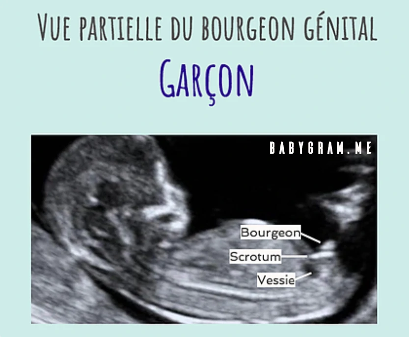 La Methode Du Bourgeon Genital Fille Ou Garcon